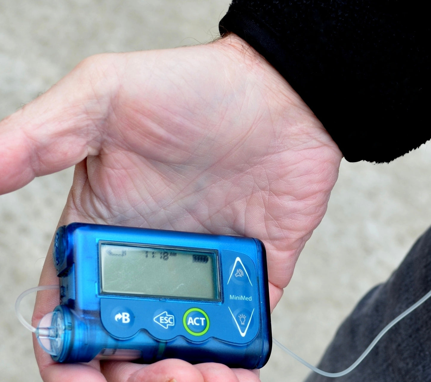Bug Out with Insulin Guide